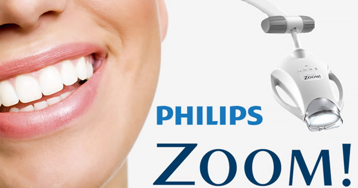 Philips Zoom Bleaching zur professionellen Zahnaufhellung bei St. Albantor Zahnarzt in Basel